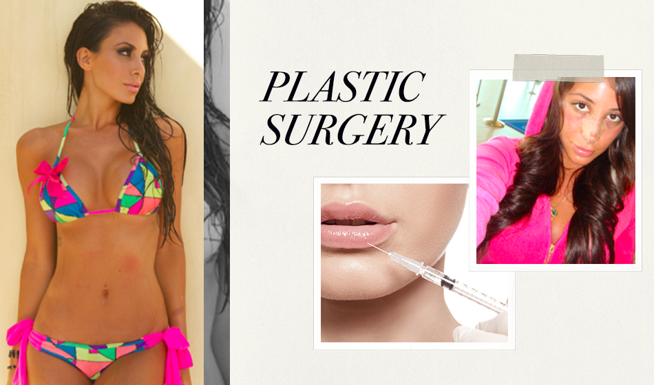 My most popular blog about plastic surgery